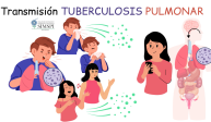 TB / TBC: generalidades sobre la tuberculosis
