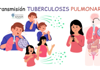 TB / TBC: generalidades sobre la tuberculosis